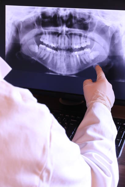 Best Emergency Tooth Extraction in Dunsmuir, CA